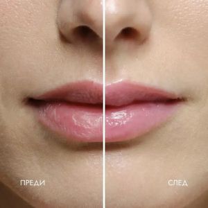 Био гланц за устни с пептиди 10 мл | Peptide Lip tint Gloss | Alteya, ROSE SUGAR JELLY